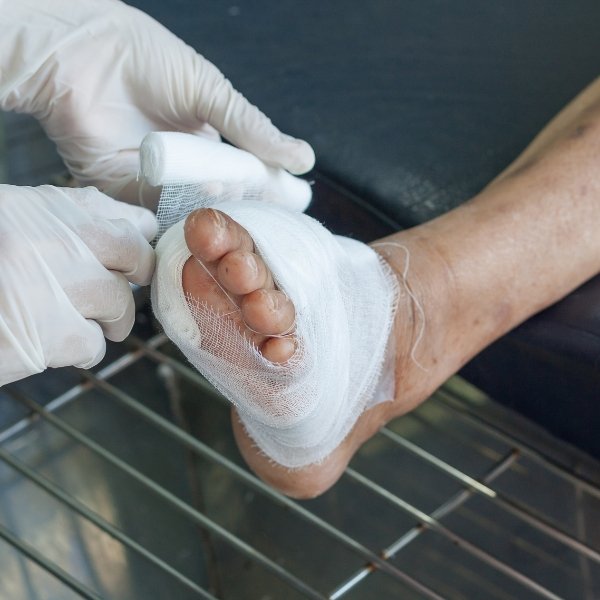 Diabetic wound care near me Post-surgical wound care near me