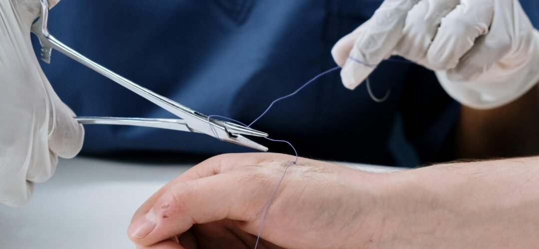 How to Tell If My Wound Is Infected